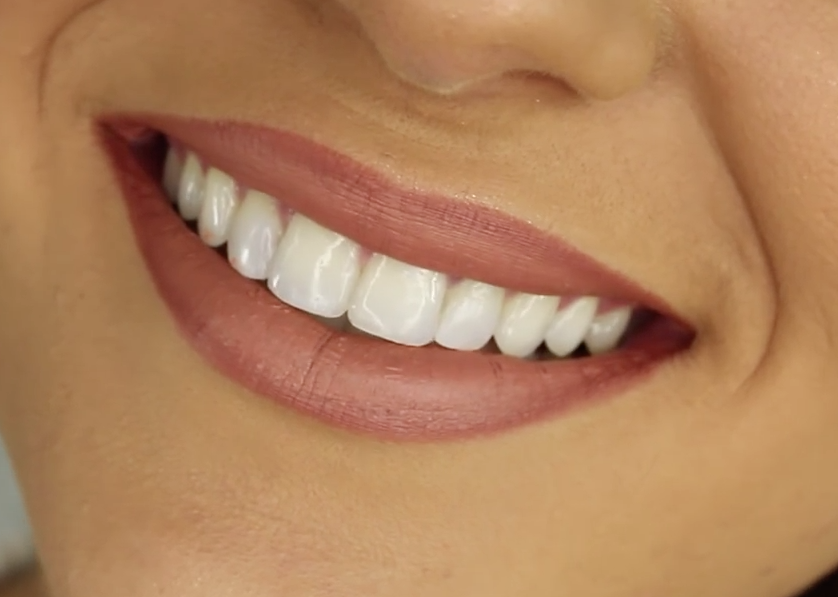 healthy shiny and strong teeth and gums